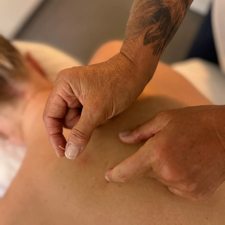 Akupunktur i Höllviken